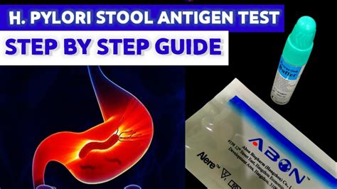 Helicobacter Pylori Antigen Test .